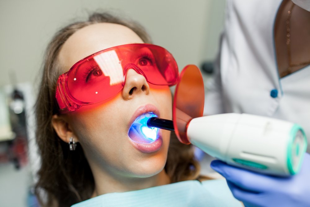 Laser Gum Contouring